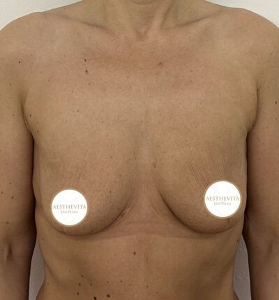 mia-femtech-003-pred