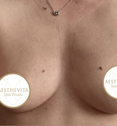 mia-femtech-023-pred