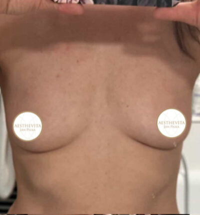 31a_mia_femtech_aesthevita_pilka-pred