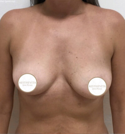 mia-femtech-035-pred