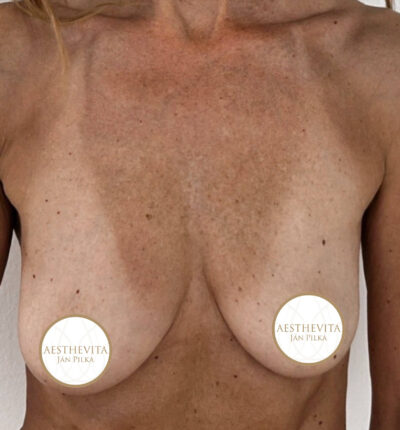 mia-femtech-036-pred-1