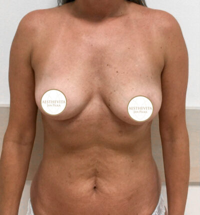 mia-femtech-038-pred