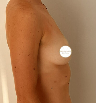 mia-femtech-039-pred