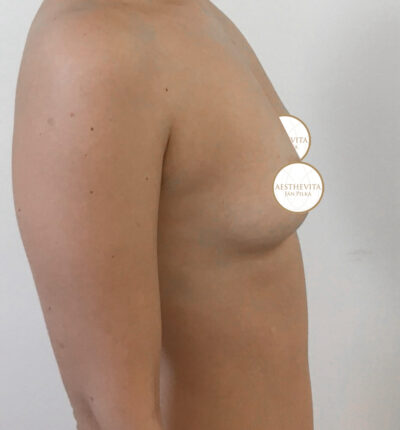 mia-femtech-042-pred