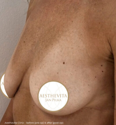 mia-femtech-052-pred-1